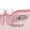 프로필 사진